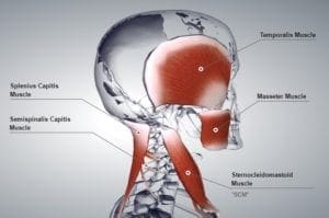 A 3D image of the human jaw muscles showing how forward head posture or chicken neck works.